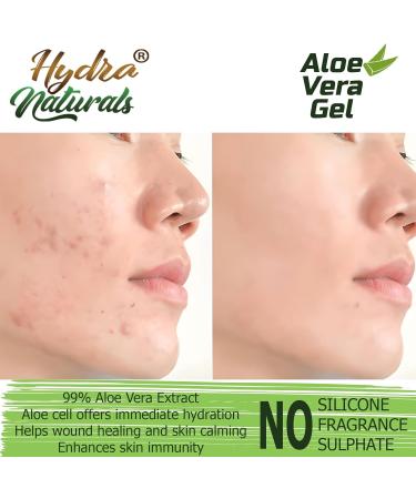 Hydra Naturals Aloe Vera Gel - 1000ml | For Hair, Skin, Face, Dry Skin | Made From Freshly Cut Aloe Vera | Multipurpose All-Over Head to Toe Care - Buy Online on GoSupps.com
