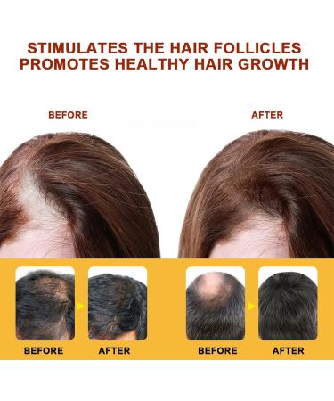 Cr me de croissance des cheveux engrais pour stimuler la croissance des cheveux produit de traitement nourrissant pour le cuir chevelu pour renforcer les cheveux pour hommes et femmes - Buy Online on GoSupps.com
