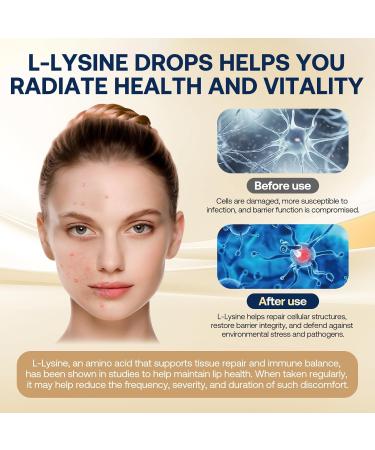 Liposomal L-lysine 1000MG Liquid Drops 13-in-1 Lysine Supplements Monolaurin Olive Leaf Extract with Vitamin C B6 D3 B12 & Zinc for Collagen Lip skin & Immune Support for Kids & Adults 2oz - Buy Online on GoSupps.com