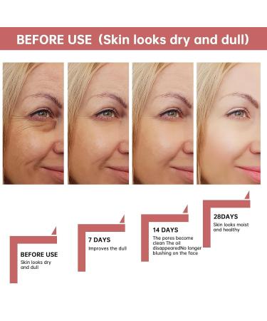 AHA 30% + BHA 2% Peeling Solution - Exfoliating Facial Serum for Glowing Skin | Chemical Peel with Glycolic Acid 30ml - Buy Now - Buy Online on GoSupps.com