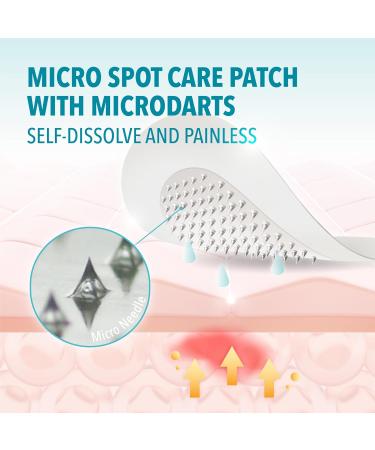 Micro Spot Care Patch - Self-Dissolving Acne Pimple Treatment | Target Zits & Blemishes with Patented 17mm Microdart Technology - Buy Online on GoSupps.com