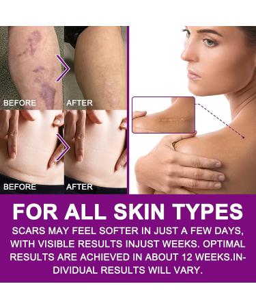Silicone Scar Sheet for Surgery, Injury, Burns, C-Section - Softens, Flattens Scars - Safe & Painless Removal - 1.6x60 Inch - Buy Online on GoSupps.com