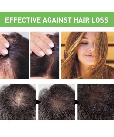 Essential Oil for Hair Density & Growth - 30ml Aibyks Natural Wild Hair Growth Oil - Buy Online on GoSupps.com