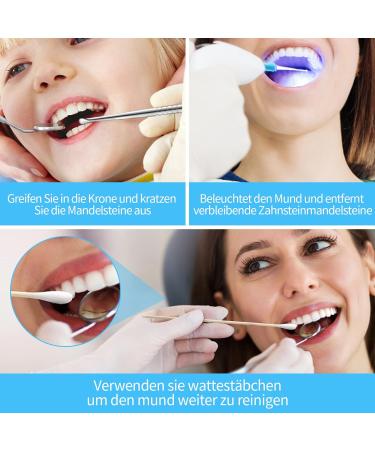 Tonsil Stone Removal Kit - Remove Almond Stones Bad Breath Solutions LED Cleaner & Cotton Swabs | Shop Internationally - Buy Online on GoSupps.com