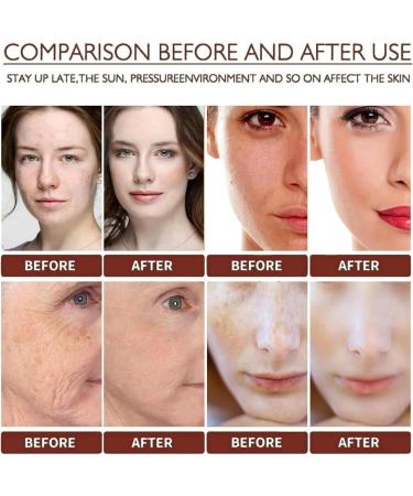 Alpha Arbutin 2% + Hyaluronic Acid Alpha Arbutin Serum for Dark Spots Removal Hyaluronic Acid Serum for Face Anti Aging Serum Smooth Skin Anti Wrinkle Serum Plump Skin Hydrating Face Serum for Women - Buy Online on GoSupps.com