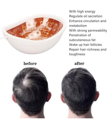 LED Hair Growth Helmet for Men and Women - Hair Regrowth Treatment - Buy Online on GoSupps.com