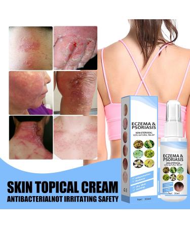 Melllop Brume de soulagement du psoriasis base de plantes brume de soulagement du psoriasis base de plantes hydrate la peau d licate de peau 1 Pi ce. - Buy Online on GoSupps.com