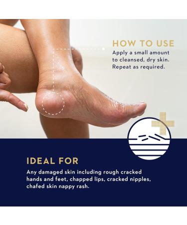 Buy Manuka Health Rescue Balm - Soothing Relief for Stressed Skin with Authentic New Zealand Raw Honey - Buy Online on GoSupps.com