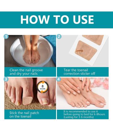 32Pcs Nail Repair Patches - Extra Strength Toenail Fungus Treatment for Damaged Nails - Buy Online on GoSupps.com