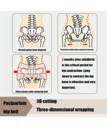 Anterior Pelvic Tilt Correction Belt | Postpartum Recovery & Sciatica Relief | Adjustable X-Large Women s Belt - Beige - Buy Online on GoSupps.com