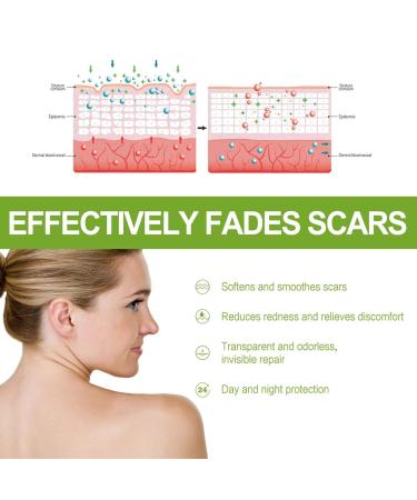 Advanced Scar Repair Serum - Intensive Overnight Cream for Face & Body - Nature Scar Treatment Gel - Pregnancy Safe - Smoothing Skin Care Essence (Green) - Buy Online on GoSupps.com