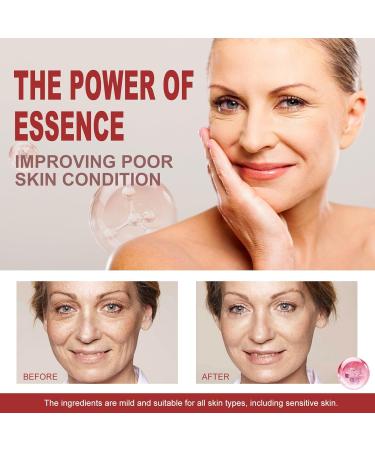 Tongyend Collagen Retinol Hyaluronic Acid Cream Retinol Cream for Face Face Moisturizer for Women Day and Night Cream Instant Face Lift Cream Anti Aging Face Lifting Skin Fix Anti Wrinkle 50ml - Buy Online on GoSupps.com