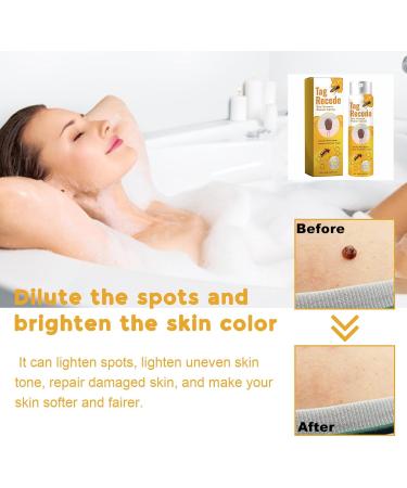 Tag Recede Bee Venom Treatment Spray - Effective Skin Tags Removal Spray (3 Pack) for Radiant Skin | Shop Internationally - Buy Online on GoSupps.com