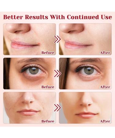 Dragons Blood Easy Cream Retinol Serum for Face Dragons Blood Face Cream Retinol Placenta Dragon Blood Cream Dragon Blood Serum Face Moisturizer Anti Aging Face Cream Face Serum for Women Skin Serum - Buy Online on GoSupps.com