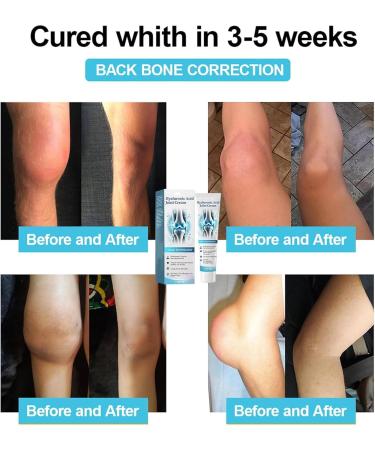 ArthroHeal Hyaluronic Acid Joint Cream - ArthroHeal Hyaluronic Acid Joint Repair Cream ArthroHeal Cream Advanced Joint and Bone Care Cream Joint and Bone T-Therapy Cream for Back (2) - Buy Online on GoSupps.com