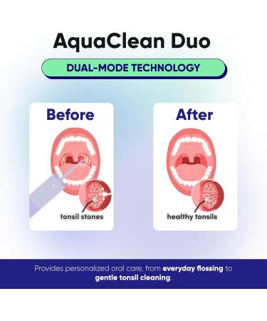 AquaClean Duo Water Flosser - Portable Waterproof Teeth Cleaner with Nozzle & Travel Bag | Dentist Designed Cordless Flosser for Braces - Pastel Purple - Buy Online on GoSupps.com