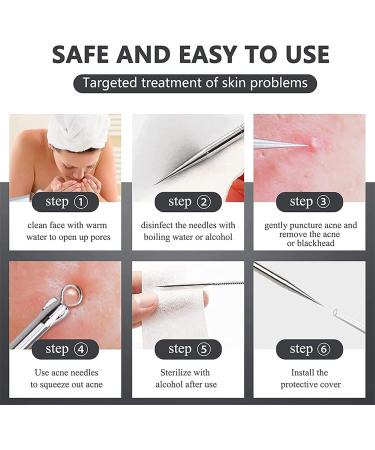Blackhead Remover Stainless Steel Blackhead Acne Tool Kit Acne Comedone Extractor Kit Professional Comedone Extractor Tools for Removing Pimple Blackheads Zit on Face - Buy Online on GoSupps.com