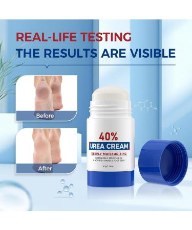 Baume R parateur pour Talons Crevass s Soin Hydratant Intense des Pieds Secs et Ab m s Soin Hydratant Non Gras pour la Peau Id al pour Toute la Famille - Buy Online on GoSupps.com
