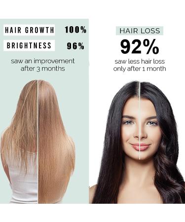 KeraHealth Women's Hair Growth Supplement with Zinc, Keratin, Biotin - 60 Capsules, Gluten-Free - Buy Online on GoSupps.com