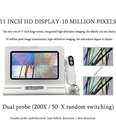 Skin Diagnosis Hair Analyzer 11 Inch Skin Scalp Detector with 50X 200X Dual Lens and 16G Storage 10 Million Pixel and 4 Spectrum Detection Pictures Comparison for Spa Salon Home Use - Buy Online on GoSupps.com