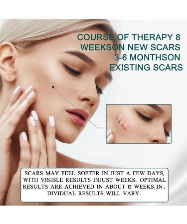 Professional Silicone Scar Tape - Soft Scar Sheets for Acne, Keloid, Burns - 1.6 x 120 Roll - Buy Online on GoSupps.com