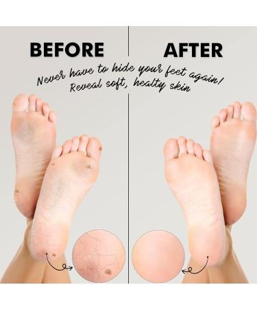 Jairestone Natural Earth Lava Pumice Stone for Feet - Foot Callus Remover - Shower Foot Scrubber - Pack of 2 - Buy Online on GoSupps.com