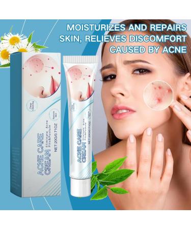 Acne Repair Face Cream - Moisturiser Face Women - Face Moisturizer for Women - Deeply Nourishes Skin - Skin Lightening Cream - Light Texture and Easy Absorption - Buy Online on GoSupps.com