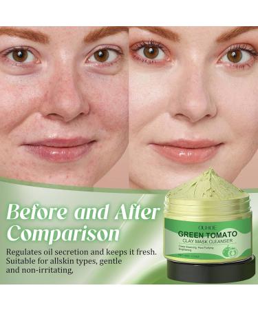 Henjunu Green Tomato Clay Mask Korean Face Mask Facial Clay Mask for Cleansing Pores and Reducing Acne and Blackheads 100g - Buy Online on GoSupps.com