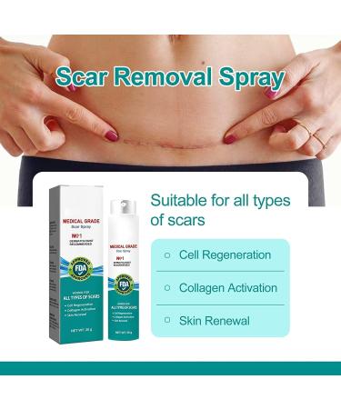 Medical Grade Scar Spray Effective Scar Removal for Surgical Scars & Stretch Marks | All Skin Types - Buy Online on GoSupps.com