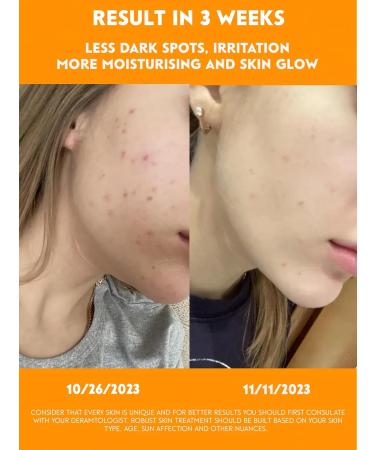 Brightening Papaya Face Milk Serum with Vitamin C & Niacinamide - 1 Fl Oz | Radiant Skin Anti-Aging Hydrating Serum | International Shipping - Buy Online on GoSupps.com