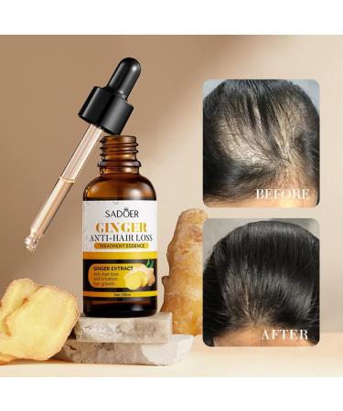 Sadoer Ginger Anti-Hair Loss Oil Sadoer Ginger Anti Hair Loss Treatment Essence Ginger Extract Hair Growth Oil - Buy Online on GoSupps.com