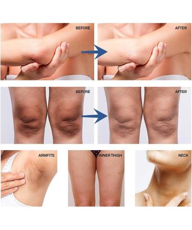 Whitening Cream for Sensitive Areas Skin Lightening Cream Brightening Cream for Intimate Areas Removes Brown Spots with Vitamin C for Armpits Knees (1) - Buy Online on GoSupps.com