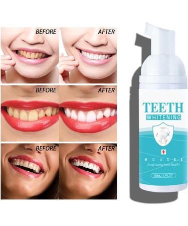 Teeth Whitening Mousse Foam - Fresh Breath Oral Care Toothpaste - Buy Online on GoSupps.com
