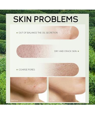 Green Tea Skincare Set - 19-in-1 Hydrating Gift Kit for Teen Girls & Women | Cleanser Serum Cream & Masks - Buy Online on GoSupps.com