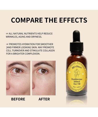 LOYOTICE 2PC Frankincense Resin Oil Infused Organic Black Seed Castor & Jojoba Oils for Face Anti-Aging Miracle Facial Moisturizer Anti-Wrinkles Natural Skincare Hydrates Skin(30ml) - Buy Online on GoSupps.com