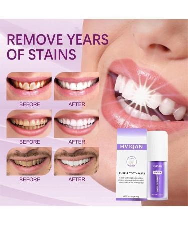 Lila Toothpaste V34 - Whitening Color Correction & Stain Removal | 30ml (4-Pack) - Brightening Booster for Teeth - Buy Online on GoSupps.com