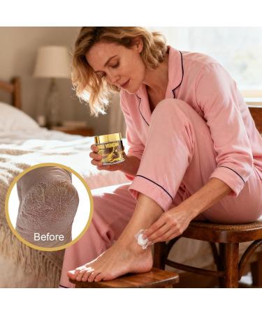 Foot Cream - 60g Soothing Balm Repairing Balm for Cracked Heels For Women and Men Travel Skin Care Pedicure Soothing Peeling Moisturizing - Buy Online on GoSupps.com