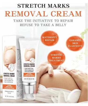 EXQST Stretch Mark Removal Cream Scars Care Cream 45g Soothing Scar Removal Cream Quick Repair New and Old Scars - Buy Online on GoSupps.com