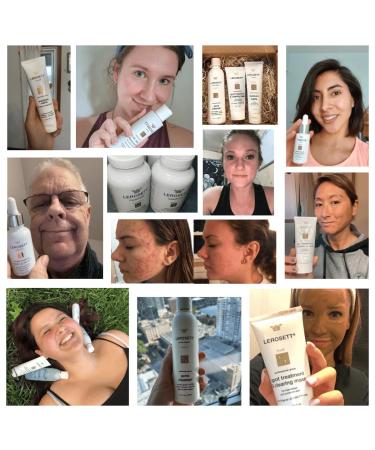 LEROSETT Acne Kit Includes Cleanser Moisturizer & Spot Treatment Mask Organic Calming Aloe & Clay Based Clears Acne Pimples Blackheads & Breakouts Vegan Acne Kit For All Skin Types - Buy Online on GoSupps.com