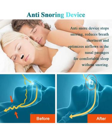 2-in-1 Anti Snoring Devices: Nose Air Purifier & Nasal Vents for Men and Women - CPAP Users - Snore Stop Sleep Aid - Buy Online on GoSupps.com