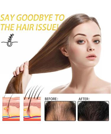 Batana Oil Organic Batana Oil for Hair Growth Hair Butter with 100% Pure Raw Batana Oil Natural Hair Growth Oil Effective Against Regional Alopecia Soothe Scalp - Buy Online on GoSupps.com