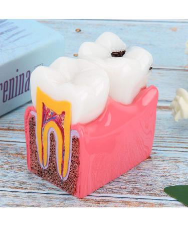 High-Quality Dental Prosthesis Model for Oral Care | International Shipping Available - Buy Online on GoSupps.com