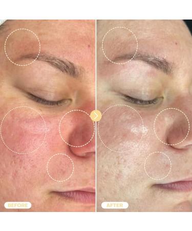 BASE LABORATORIES Hypochlorous Acid Spray for Face & Skin - Travel Size - Facial Toner Spray & Cleaner - Skin Repair Solution helps reduce redness, Irritations, acne - HOCL Molecule Spray 2oz 2 Fl Oz (Pack of 1) - Buy Online on GoSupps.com