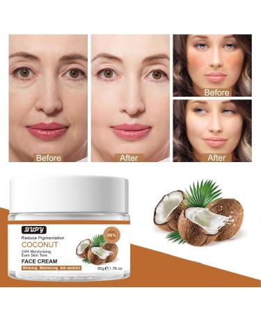 Coconut Face Cream | 24-Hour Moisturising & Revitalising | Reduce Pigmentation & Even Skin Tone | 50g - Shop Internationally - Buy Online on GoSupps.com