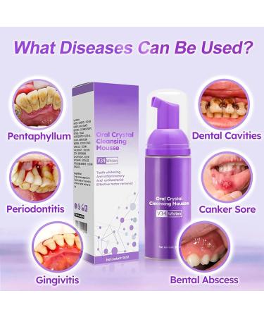 GFOUK Oral Crystal Cleansing Mousse - Tooth Mousse & Stain Removal Foam Purple Toothpaste for Whitening & Caries Prevention (2 Pieces) - Buy Online on GoSupps.com