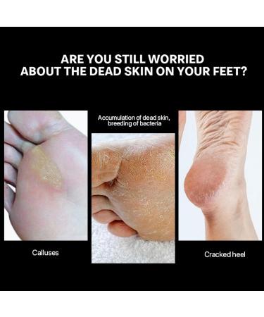 Generic Round Stainless Steel Foot Polishing Head Nail Grinding Cap Foot Grinding and Foot Repair Drill Tool - Buy Online on GoSupps.com