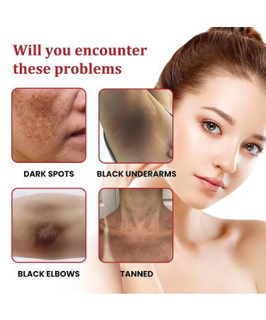 Dark Spot Remover for Face & Body - Age, Brown, Sun Spot & Freckle Remover for Men & Women - 0.04 oz - Buy Online on GoSupps.com
