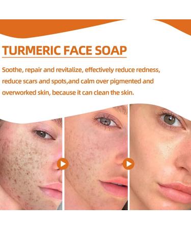 Kojic Acid Soap Turmeric Soap Bar Vitamin C soap Bar Mild soap for Removing acne Blackheads and Dark Spots Deeply Cleaning Hyaluronic Acid and Moisturizing Face and Body yellow - Buy Online on GoSupps.com