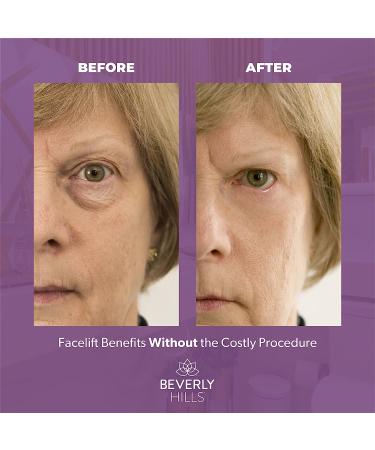 Beverly Hills Instant Facelift Anti Aging Eye Serum | Dark Circles, Puffy Eyes, Wrinkles, Under Eye Bags & Fine Lines Treatment | Crows Feet Reduction in 90 Seconds | 30mL (120 Days Supply) - Buy Online on GoSupps.com