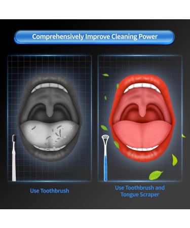 Annhua Tongue Cleaner Set - 4 Color Tongue Scrapers for Fresh Breath | International Shipping - Buy Online on GoSupps.com
